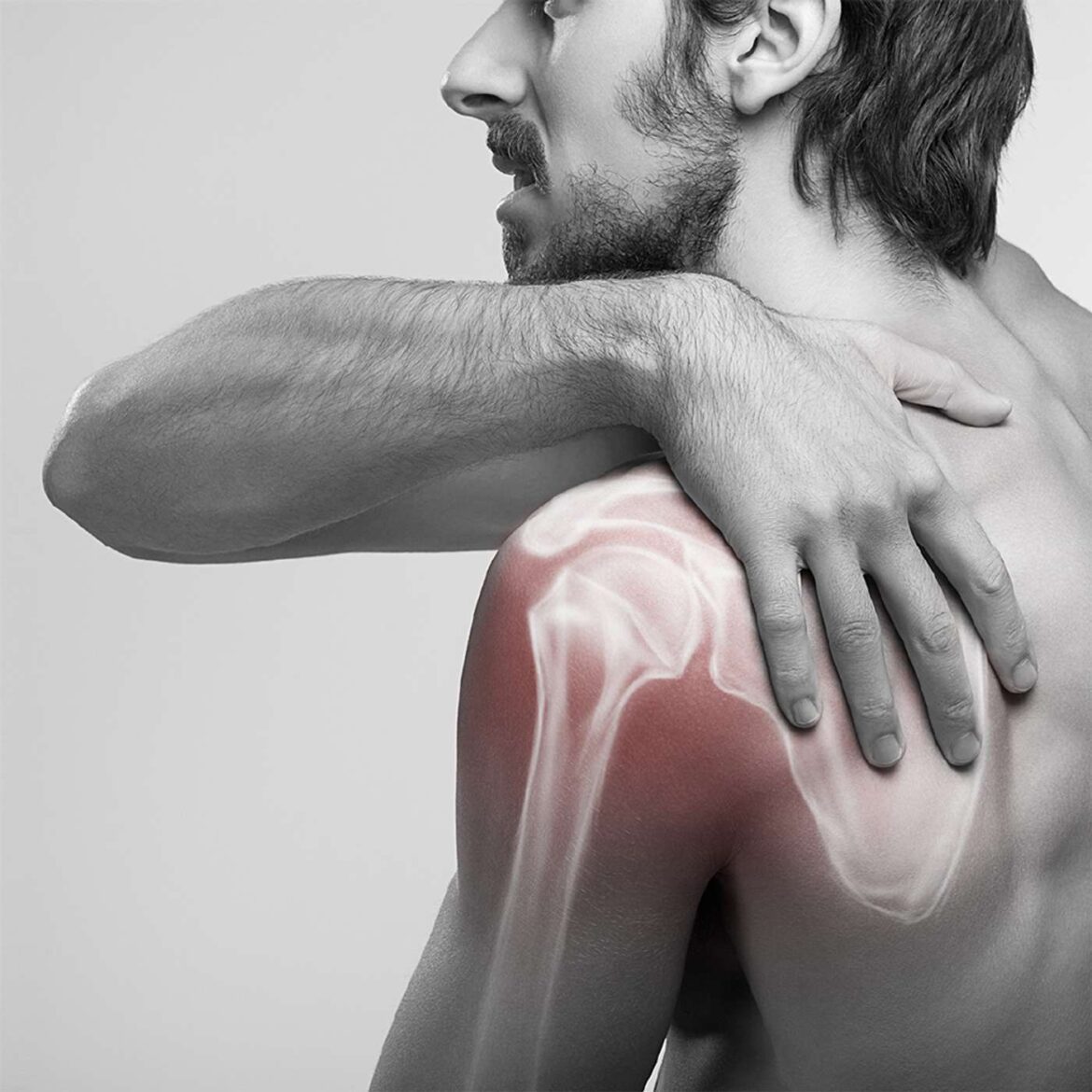 37: frozen shoulder and other musculoskeletal issues