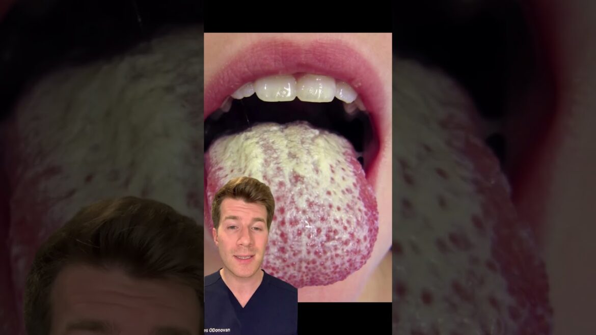 13 Skin Signs Associated With Diabetes #shorts #doctor #diabetes #medical