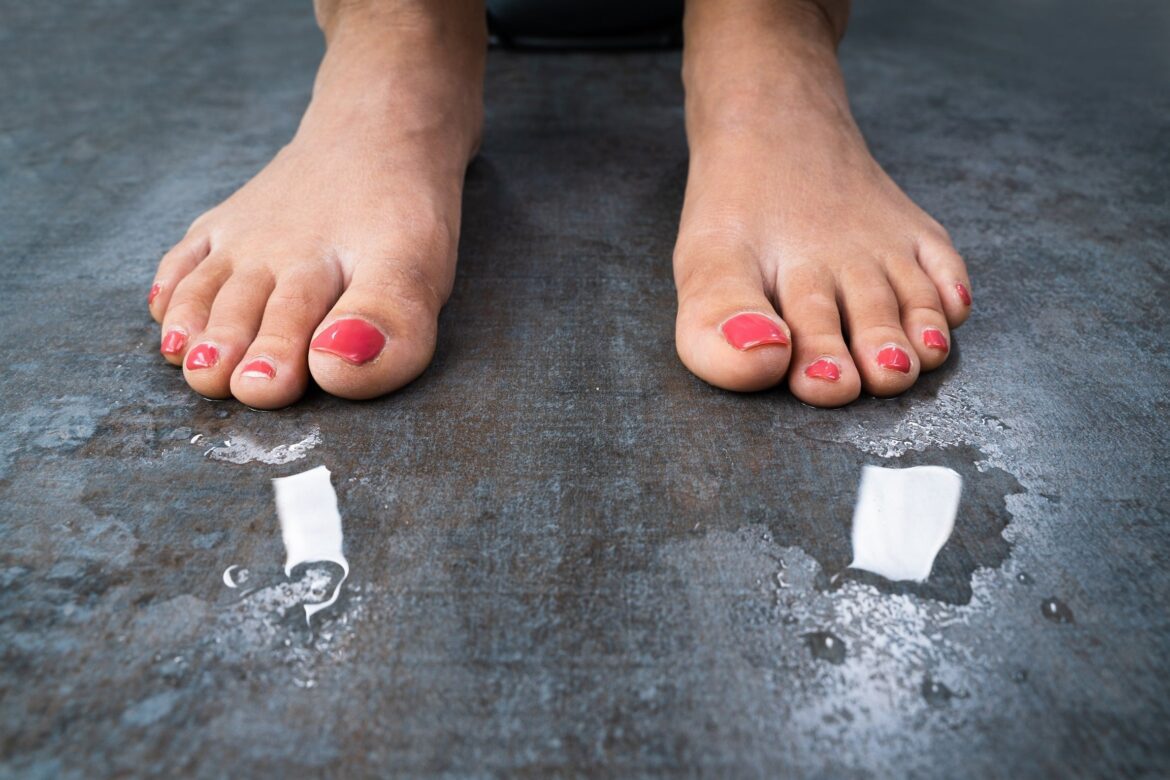 Sweaty feet bf556e2a 7d61 450f 8c2a 64bd21270936