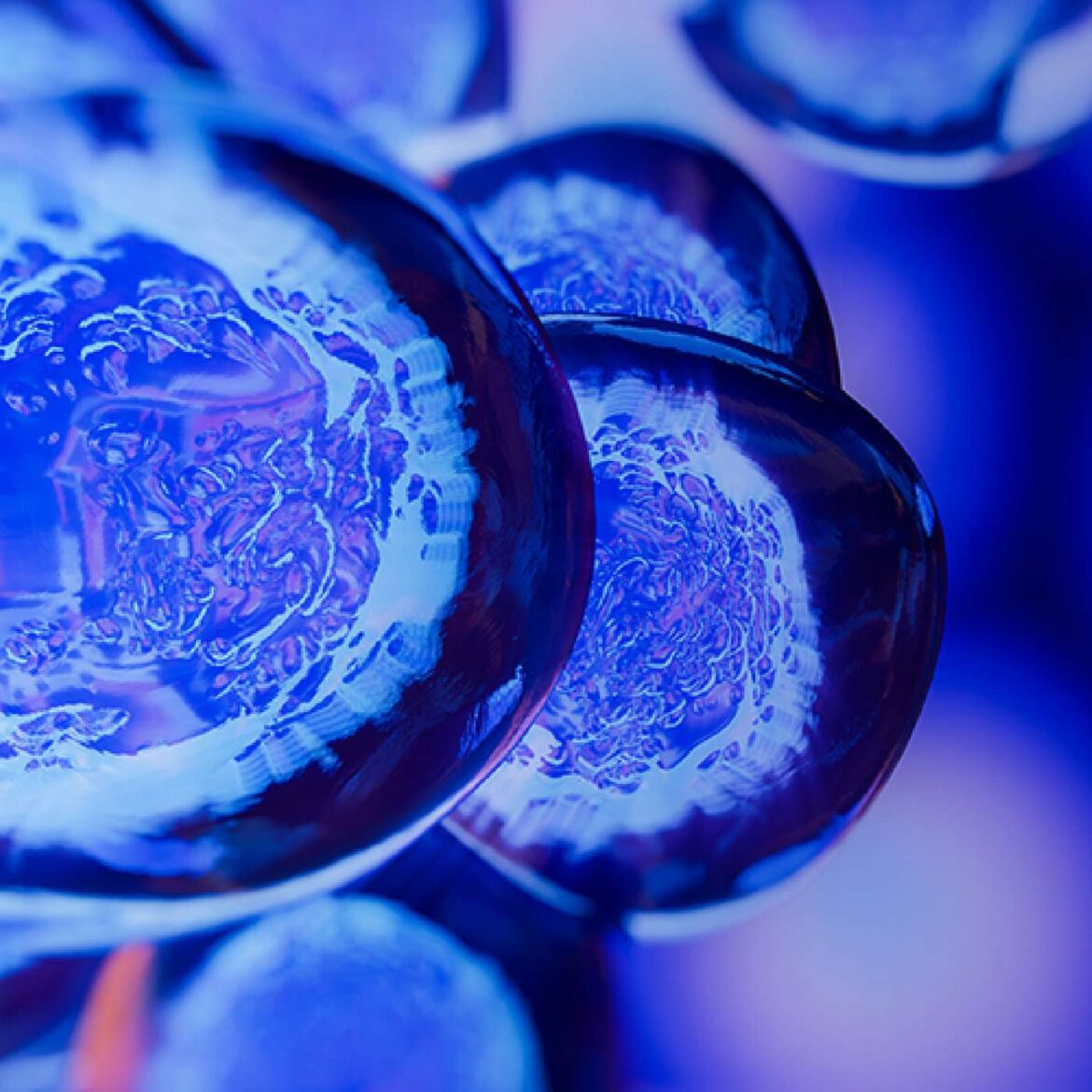 54: islet cell replacement therapy, with manasi sinha jaiman, md, mph