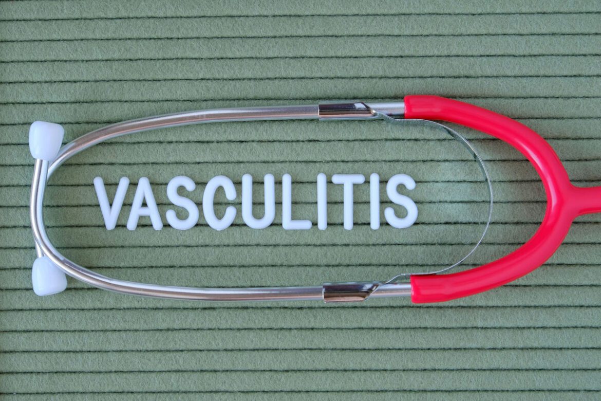 Vasculitis f39d2388 6188 4e3d a22b 0b4e0aed3468 1200x1200