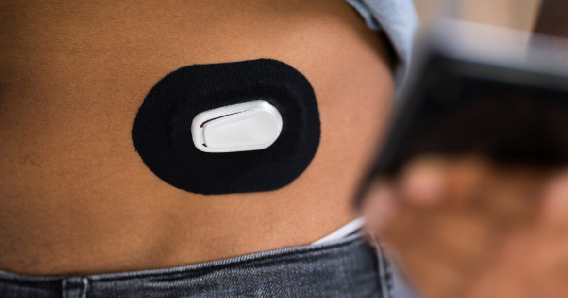 Man testing glucose level with continuous glucose monitor