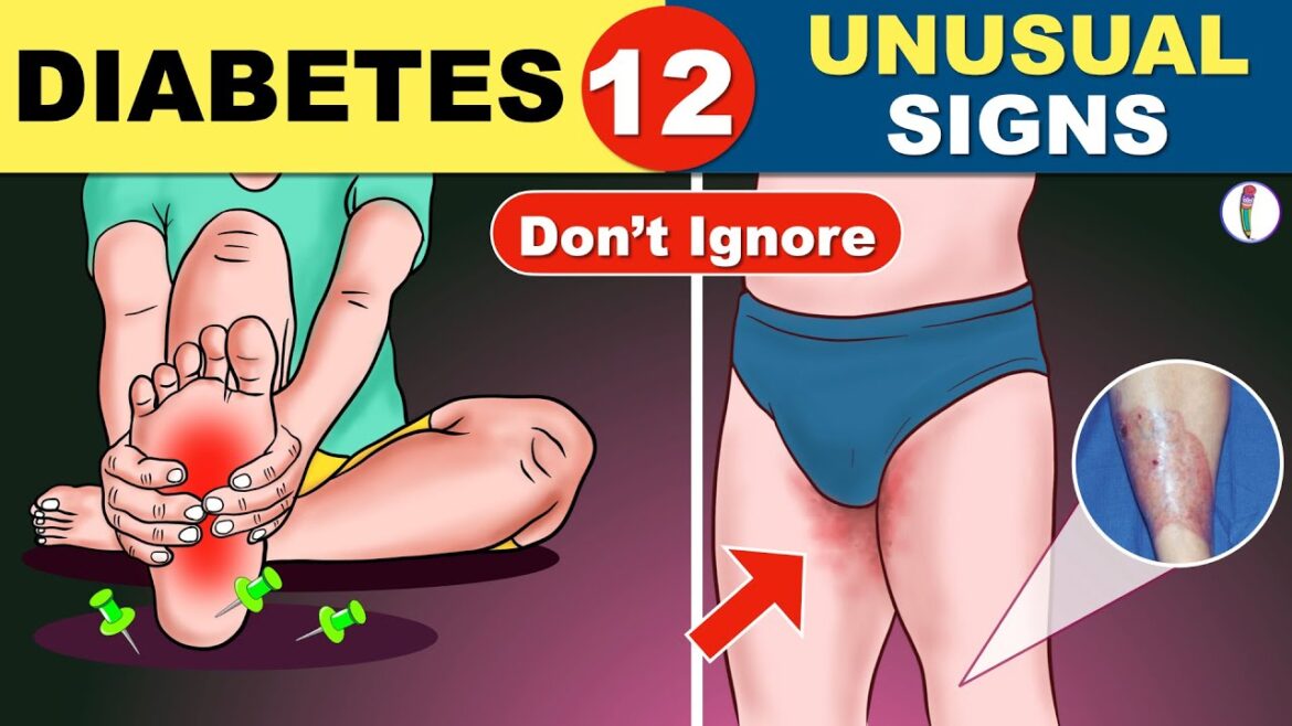 12 Unusual Symptoms of Diabetes | Diabetes Symptoms | Diabetes