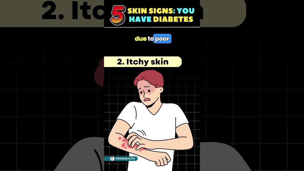5 Hidden Skin Signs of Diabetes | Diabetes skin signs