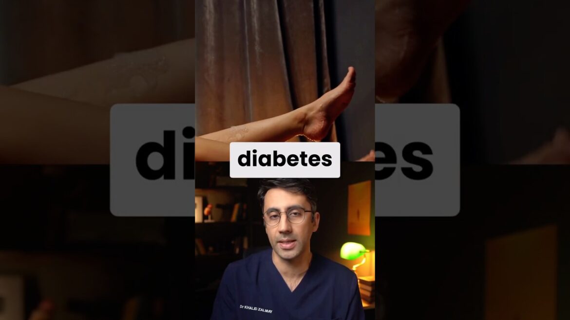Diabetes WARNING Signs in Feet / Legs #type2diabetes #diabetessigns #prediabetes