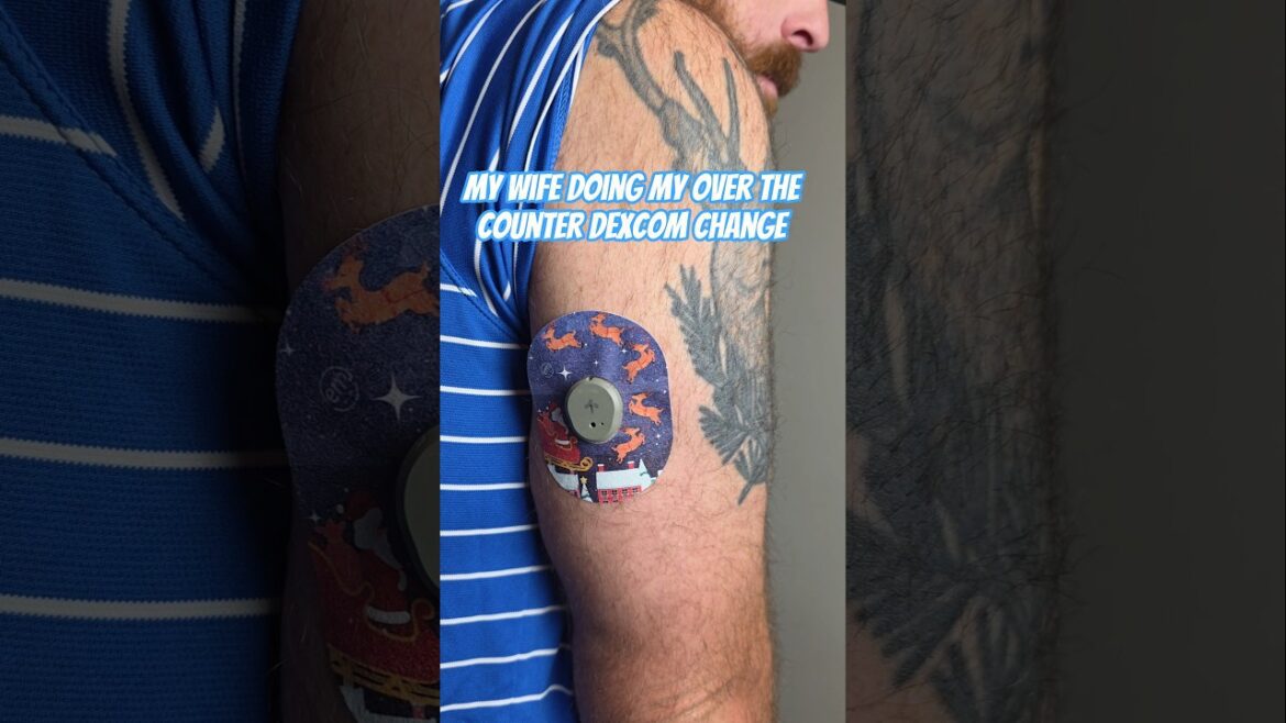 My wife doing my over the counter Dexcom change #diabetes