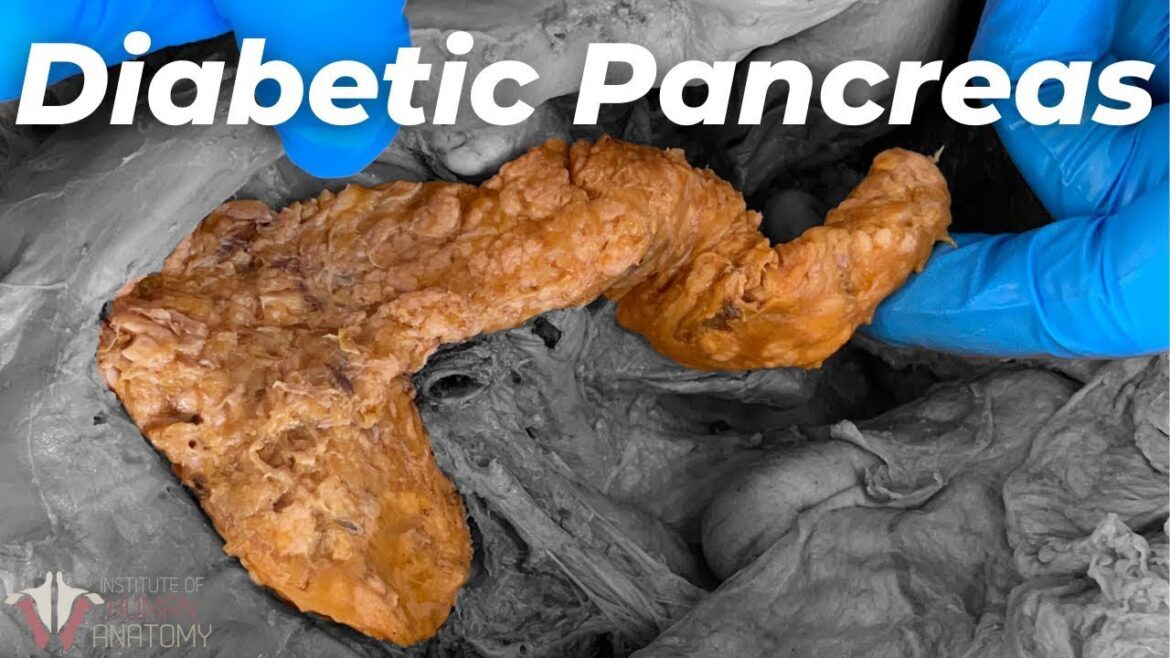 What Diabetes Does to the Body | Can You Reverse