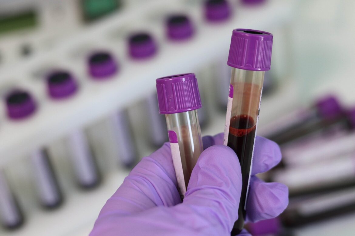 Lab blood