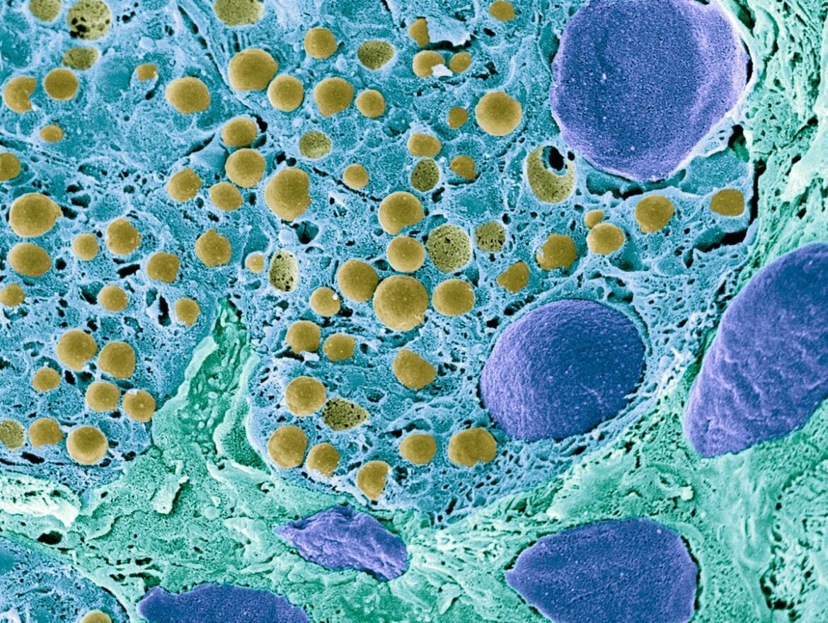 Pancreas tissue SEM