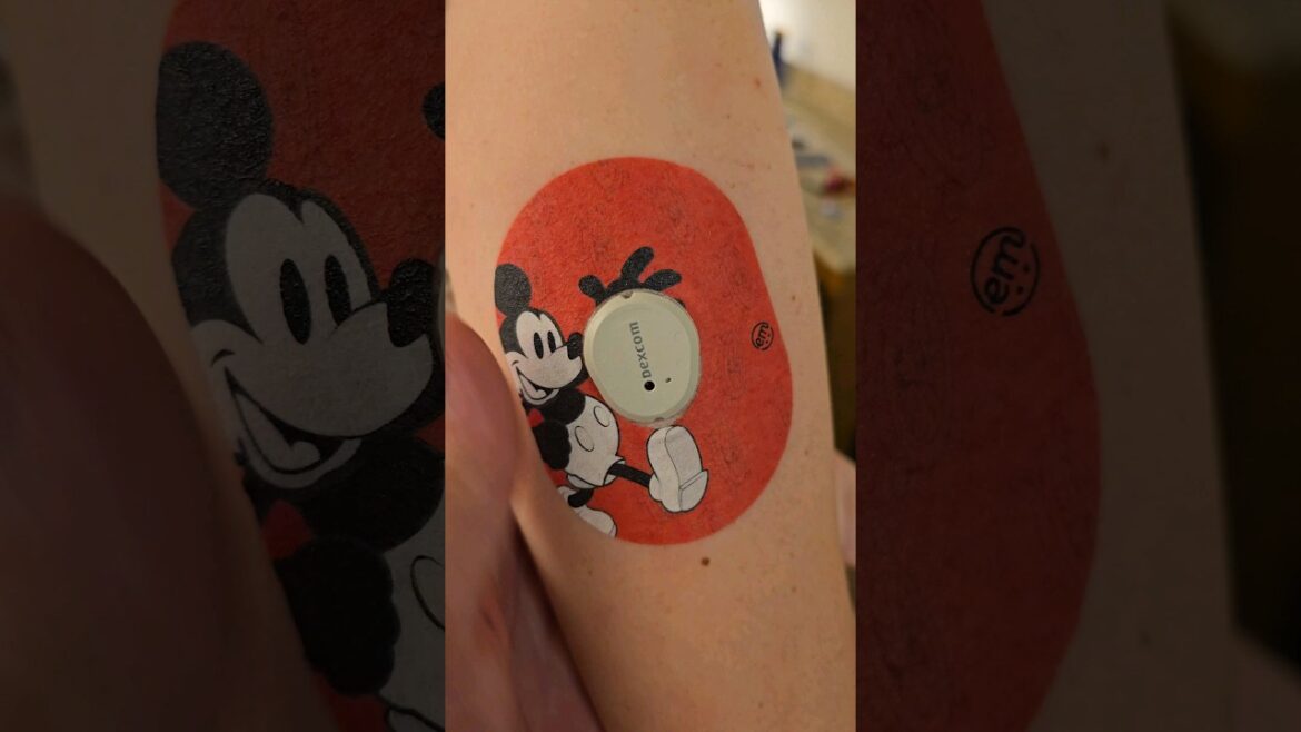 Dexcom Change at Disney World for Friends for Life Conference