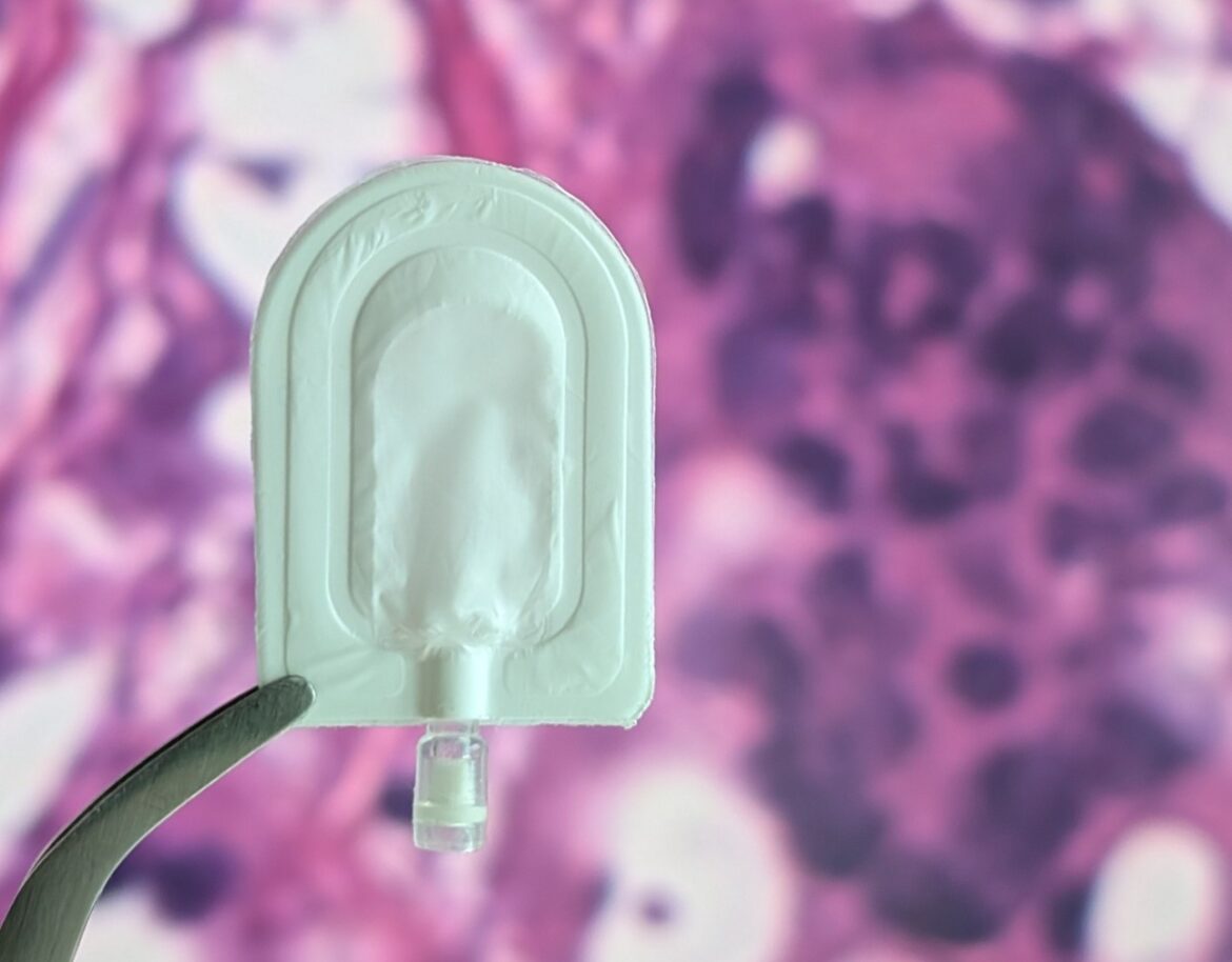 Encapsulation device