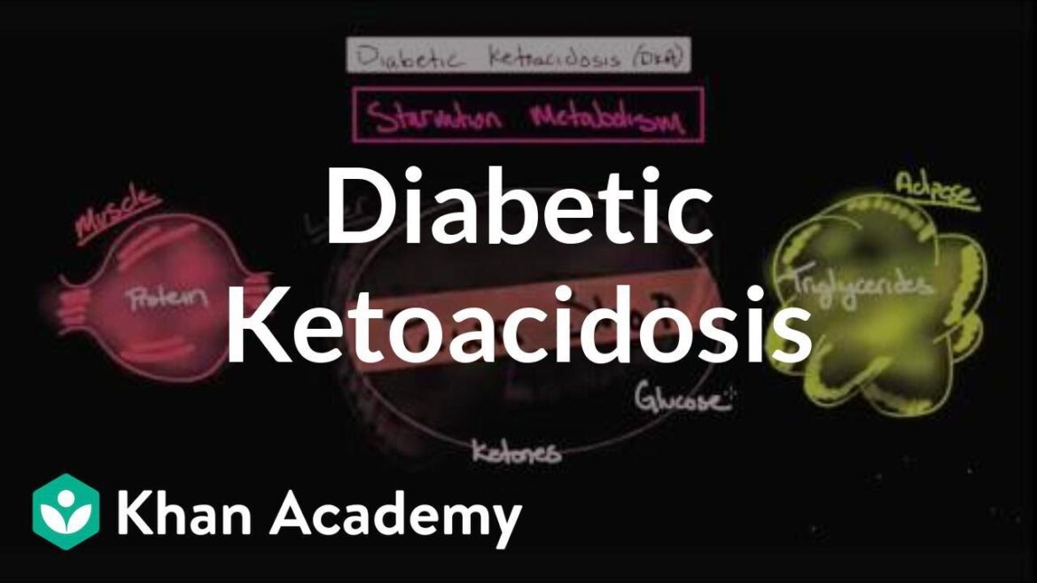 Acute complications of diabetes Diabetic ketoacidosis | NCLEX RN |