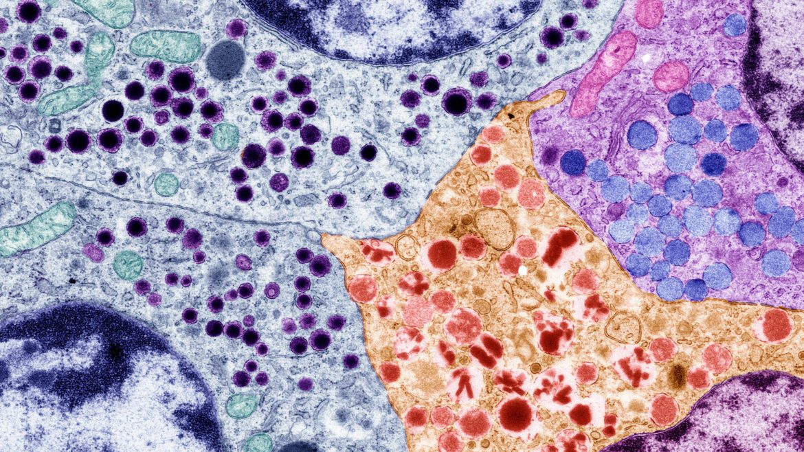 Gene Modified Cells Offer Hope for Type 1 Diabetes